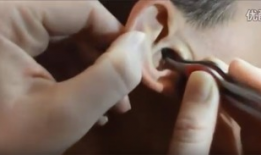 挖耳朵视频,视频教你轻松清洁耳道